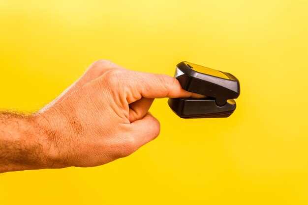 Рекомендуемый пробег для замены помпы